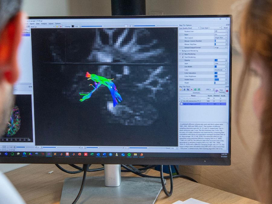 Magnetic Resonance Imaging