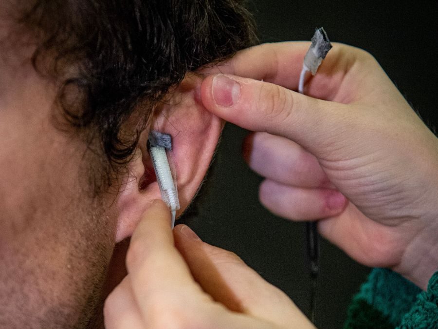 Transcutaneous vagus nerve stimulation